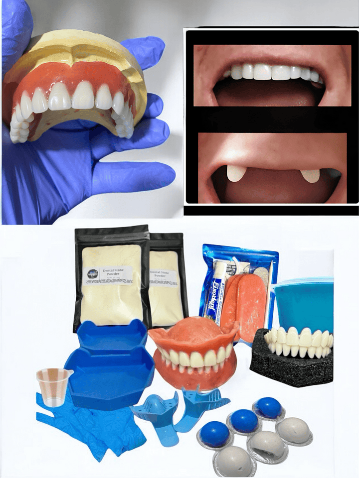 DIY Beginner Smile Kit/ Putty Impression Upper Lower Full Set/ Make Partial Everything You Need - DIY Denture Shop LLC ™