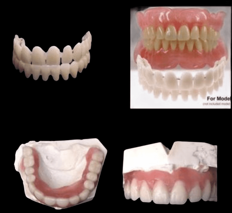 Home Denture Making Kit - Acrylic Teeth Impression Kit